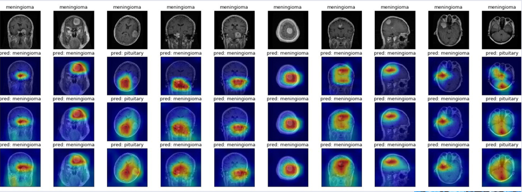 CO3519 Lecture 1 - Tumour Scan Predictions AI.png